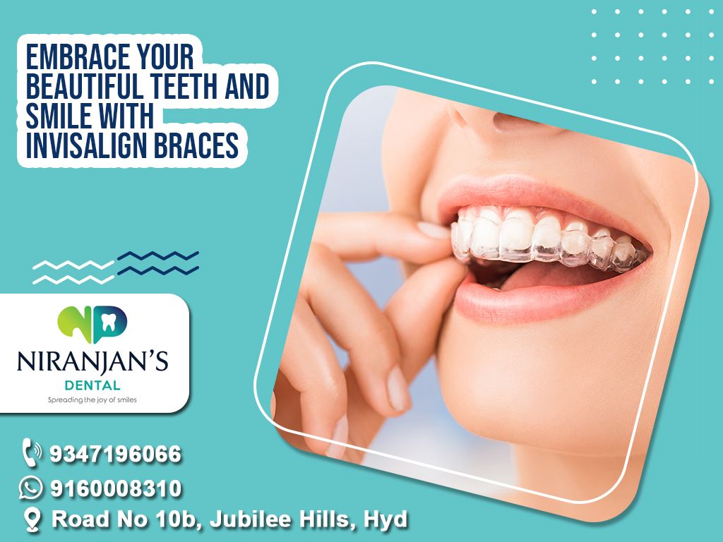 Invisible Aligners In Hyderabad