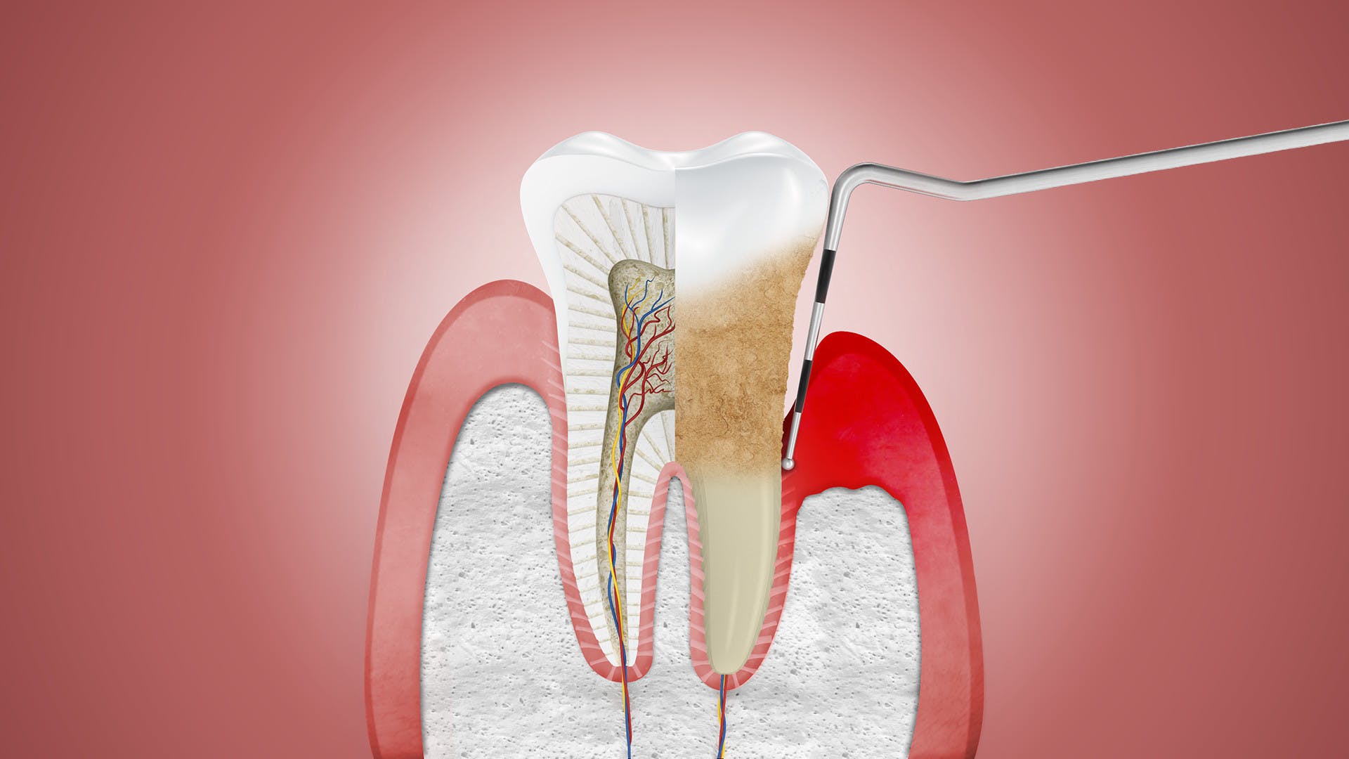 periodontics-treatment