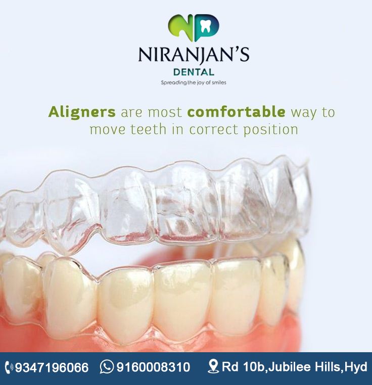 Read more about the article Best dental clinic in jubilee hills