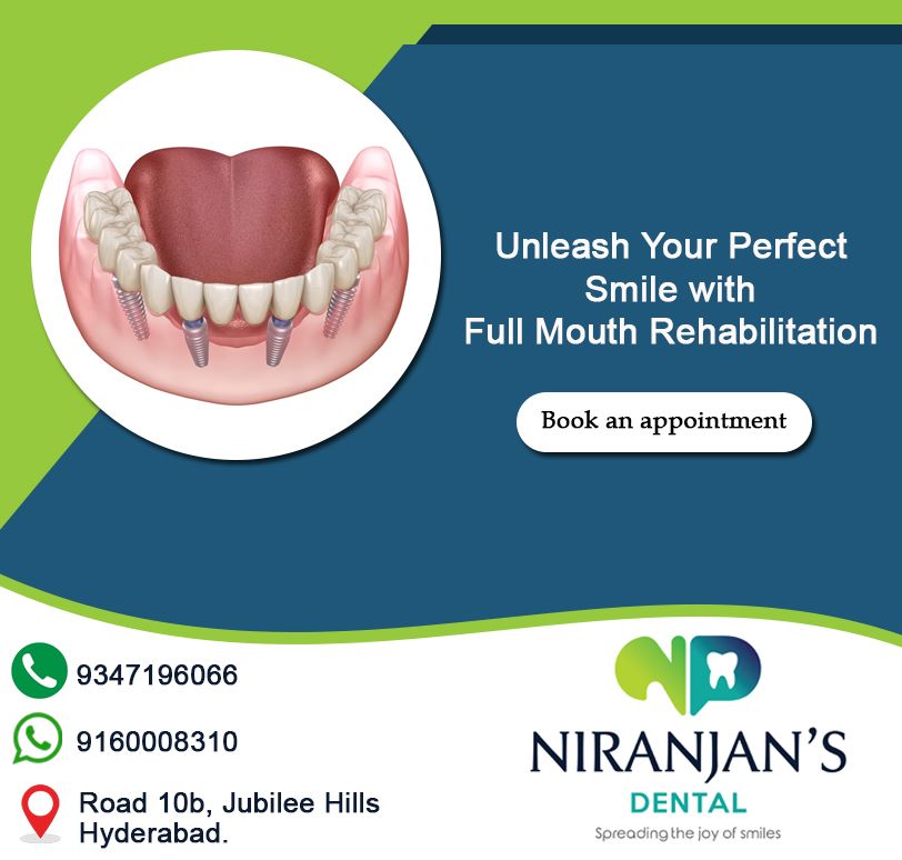 Read more about the article full mouth rehabilitation