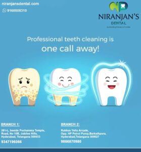 Read more about the article Best Dental Clinic in jubilee hills