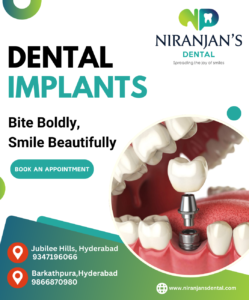 Read more about the article Benefits Of All On 4 Dental Implants