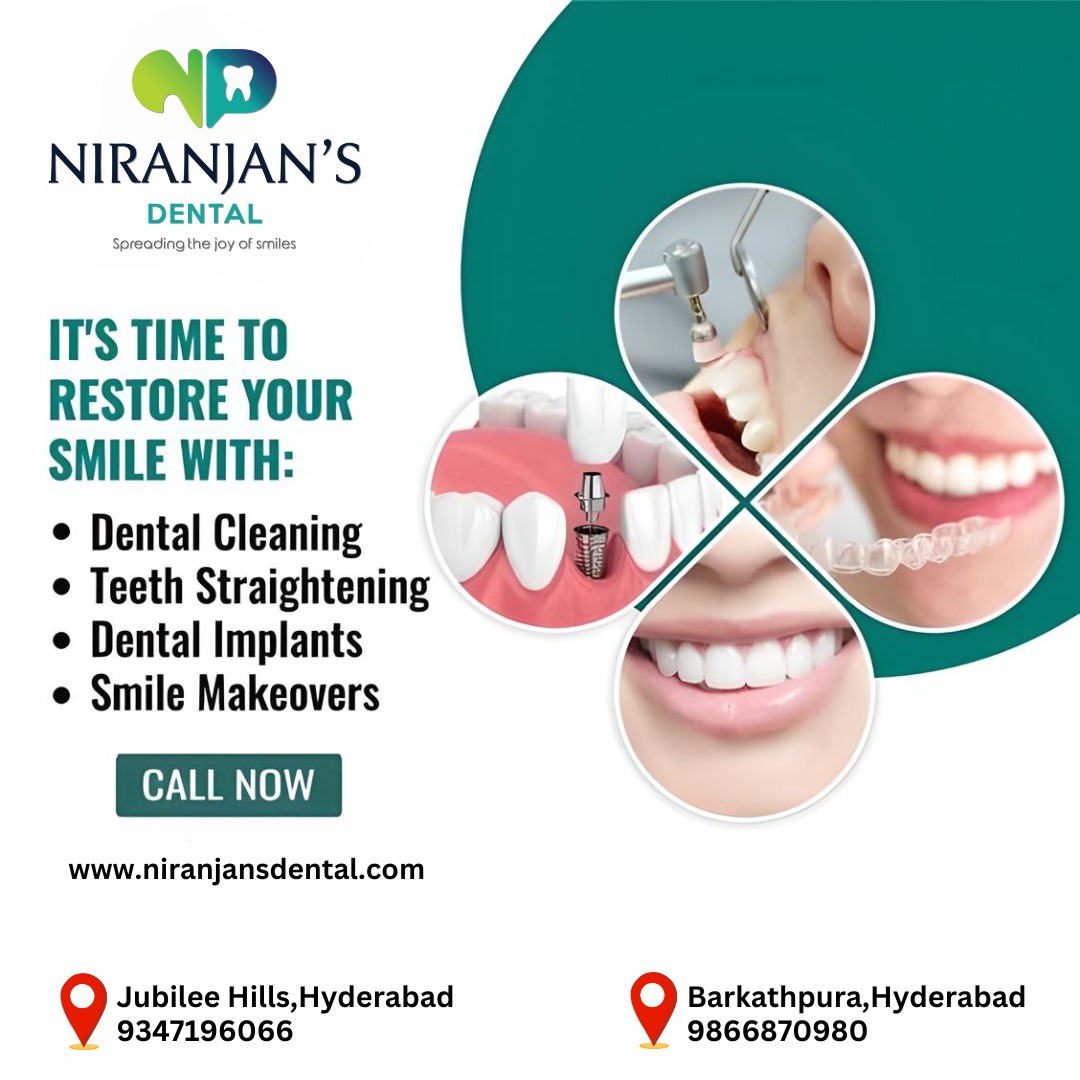 Read more about the article Full Mouth Dental Implants Jubilee Hills