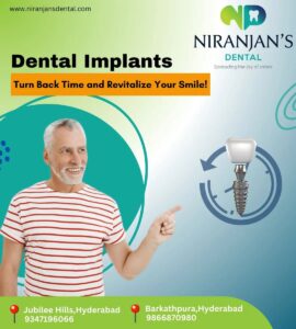 Read more about the article Affordable All On 4 Dental Implants