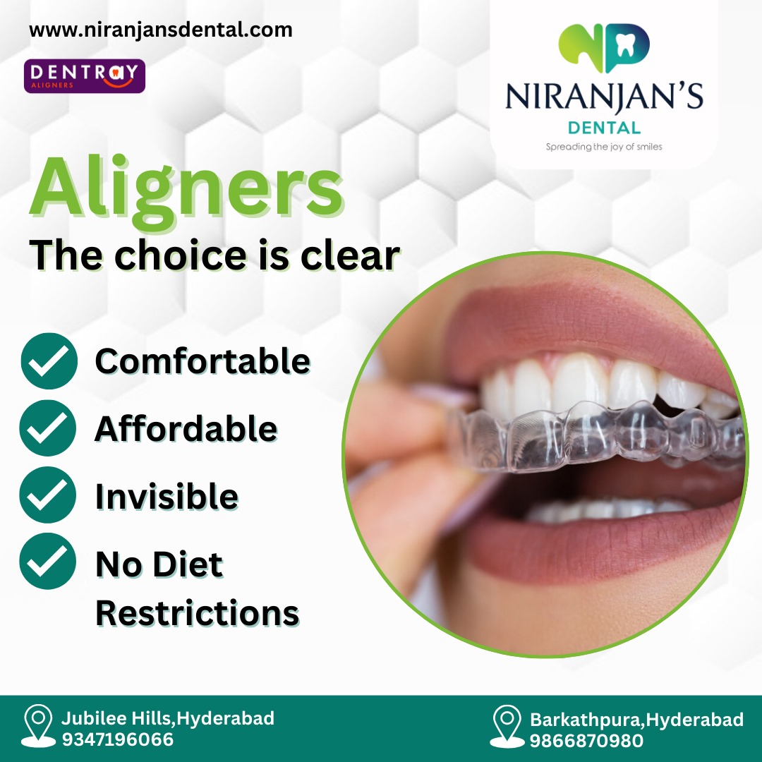 You are currently viewing Invisible aligners in jubilee hills hyderabad