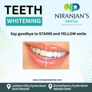 Read more about the article Teeth whitening in jubilee hills