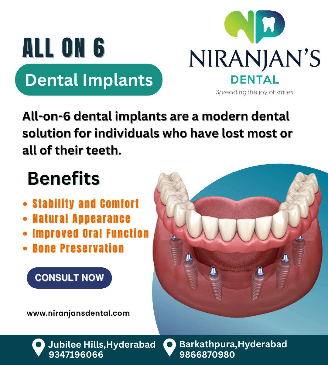 Read more about the article Full mouth dental implants in jubilee hills hyderabad